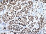 WEE1 Polyclonal Antibody