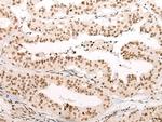 VPS51 Antibody in Immunohistochemistry (Paraffin) (IHC (P))