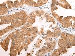 EMC7 Antibody in Immunohistochemistry (Paraffin) (IHC (P))
