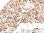 KNOP1 Antibody in Immunohistochemistry (Paraffin) (IHC (P))