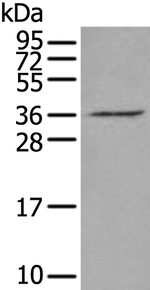 VGLL2 Antibody in Western Blot (WB)