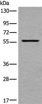 UBOX5 Antibody in Western Blot (WB)