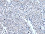 RAC2 Polyclonal Antibody