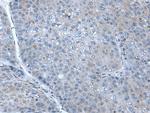 HIN-1 Polyclonal Antibody