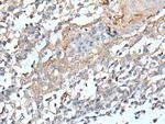 STARD4 Polyclonal Antibody
