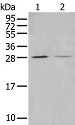 STARD4 Antibody in Western Blot (WB)