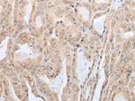 PRH2 Polyclonal Antibody