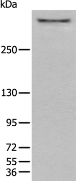 CUBN Antibody in Western Blot (WB)
