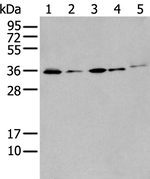 HOXC4 Antibody in Western Blot (WB)
