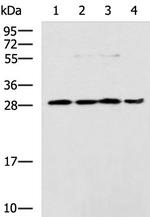HOXC9 Antibody in Western Blot (WB)