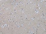 IL9R Antibody in Immunohistochemistry (Paraffin) (IHC (P))