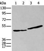 IL9R Antibody in Western Blot (WB)