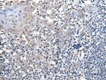 HOXD1 Antibody in Immunohistochemistry (Paraffin) (IHC (P))