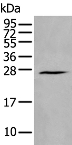 HAND1 Antibody in Western Blot (WB)