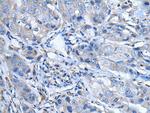 LTBP4 Antibody in Immunohistochemistry (Paraffin) (IHC (P))