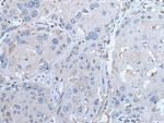 LTBP4 Antibody in Immunohistochemistry (Paraffin) (IHC (P))