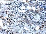 WIPF1 Polyclonal Antibody