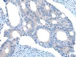 UNC5B Polyclonal Antibody
