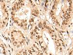RMP Polyclonal Antibody