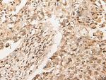 RMP Antibody in Immunohistochemistry (Paraffin) (IHC (P))