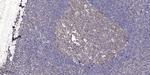 ASF1B Polyclonal Antibody