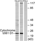 CYB561D1 Antibody in Western Blot (WB)