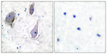 PMP22 Polyclonal Antibody