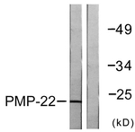 PMP22 Antibody in Western Blot (WB)
