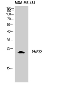 PMP22 Antibody in Western Blot (WB)