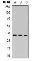 HEY2 Polyclonal Antibody