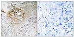 SCN9A Antibody in Immunohistochemistry (Paraffin) (IHC (P))