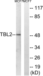TBL2 Antibody in Western Blot (WB)