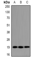 UBE2G1 Antibody in Western Blot (WB)