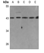 COL26A1 Antibody in Western Blot (WB)