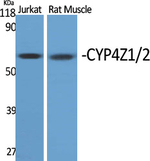 CYP4Z1/CYP4Z2P Antibody in Western Blot (WB)