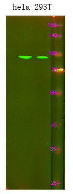 SPINK7 Polyclonal Antibody