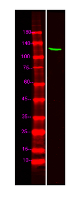 TOPORS Polyclonal Antibody