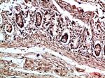 COL17A1 Antibody in Immunohistochemistry (Paraffin) (IHC (P))