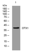OTX1 Polyclonal Antibody