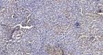 SOD3 Polyclonal Antibody