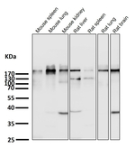 ACACB Antibody in Western Blot (WB)