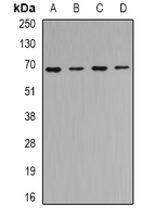 TRIP10 Antibody in Western Blot (WB)
