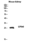 GPR40 Antibody in Western Blot (WB)