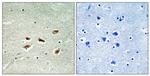 p39 Polyclonal Antibody