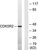 p39 Antibody in Western Blot (WB)