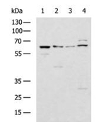 GBA Antibody in Western Blot (WB)