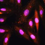 KAP3 Polyclonal Antibody