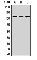KAP3 Antibody in Western Blot (WB)