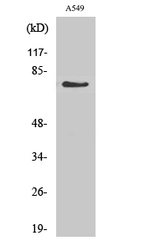 GUCY1A1 Antibody in Western Blot (WB)