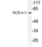 GUCY1A1 Antibody in Western Blot (WB)
